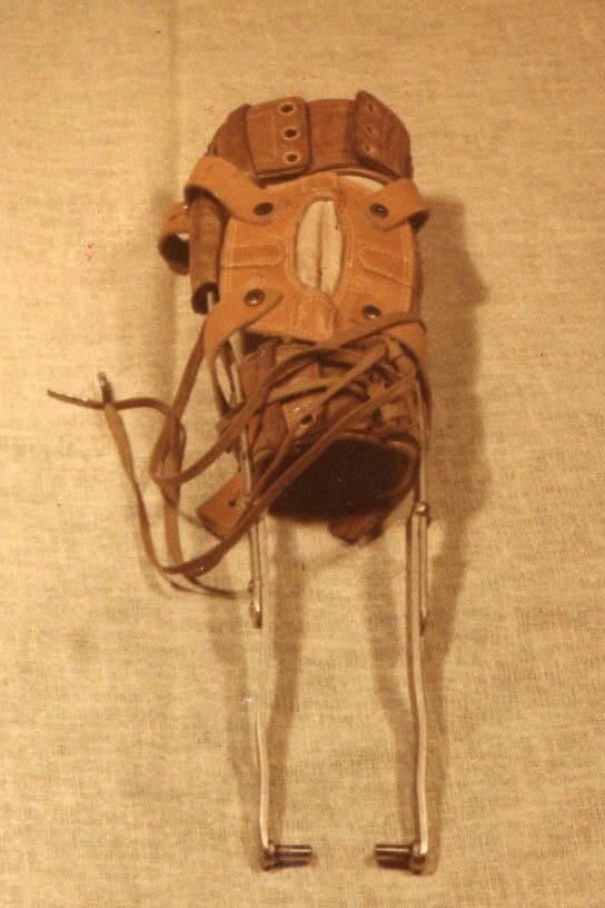A two-year-old girl who contracted polio in the early 1940s received this leg brace to wear.