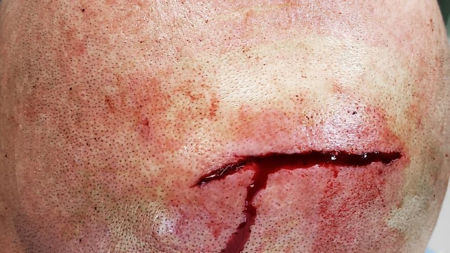 William Rogers, a former guard at the Leavenworth Detention Center, was struck in the head with a tray while working there.